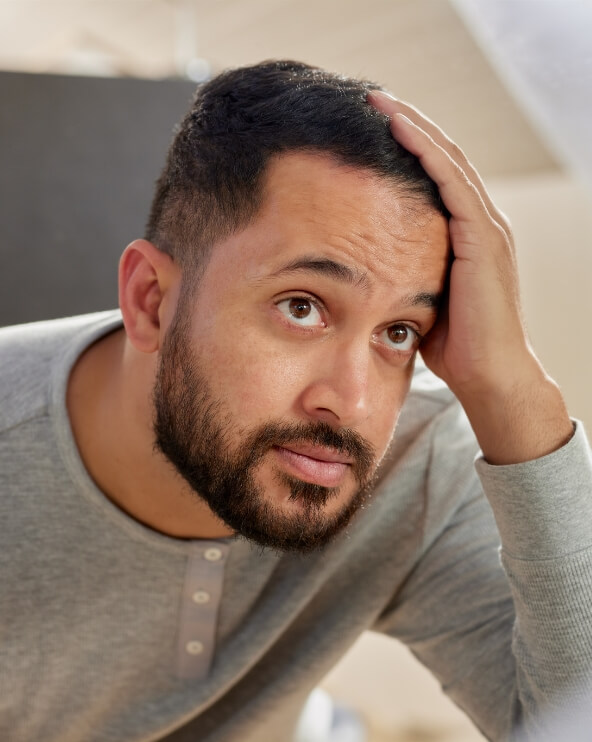 mid-adult-multiethnic-man-worried-about-hair-loss-2025-01-10-03-16-29-utc